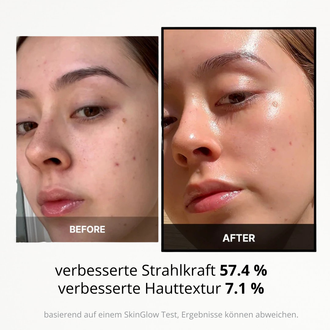 SkinGlow I 6-in-1-gesichtsbehandlung