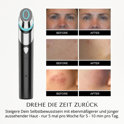 SkinGlow I 6-in-1-gesichtsbehandlung